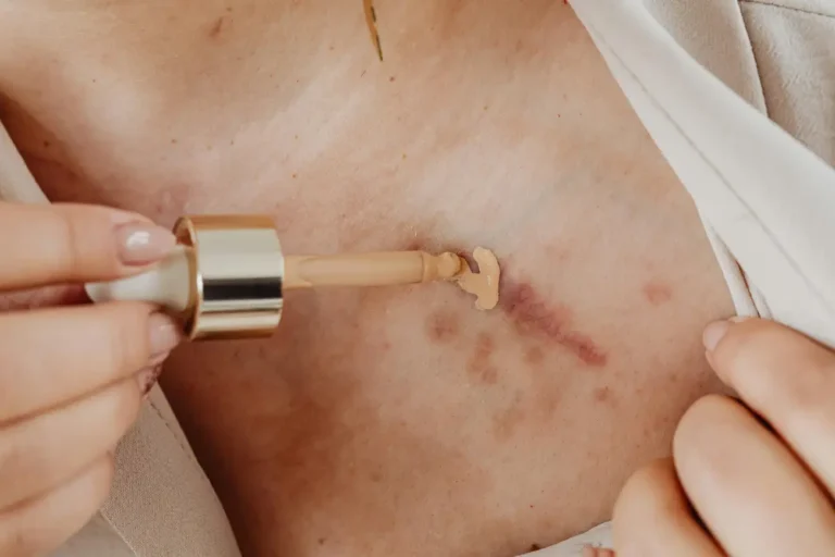 Como escolher o corretivo certo para minha pele?