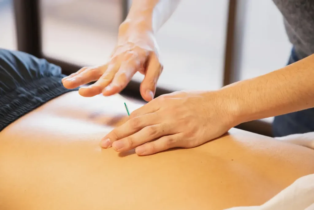 O que é Acupuntura a Laser e como funciona?