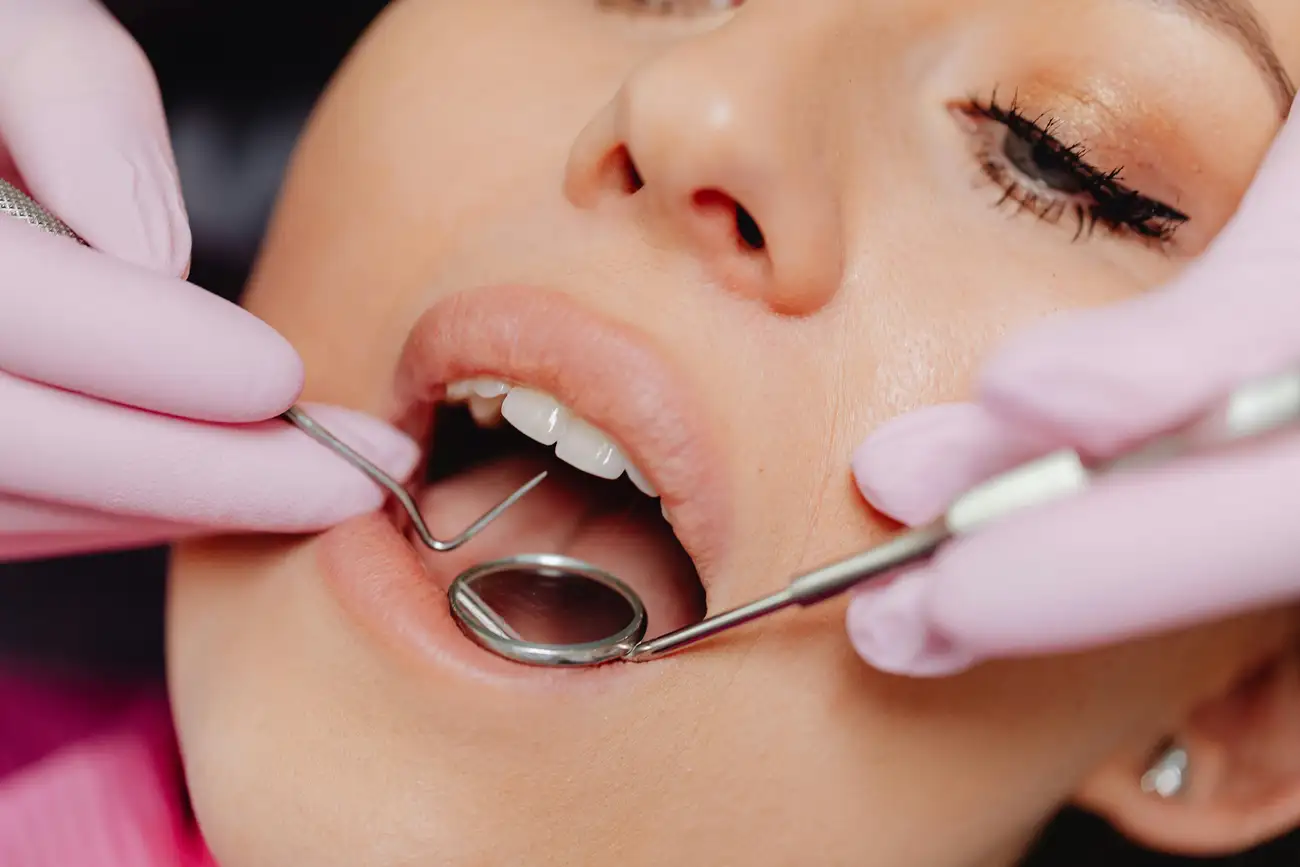 Quais são os Melhores Planos de Saúde Dental do Bradesco?